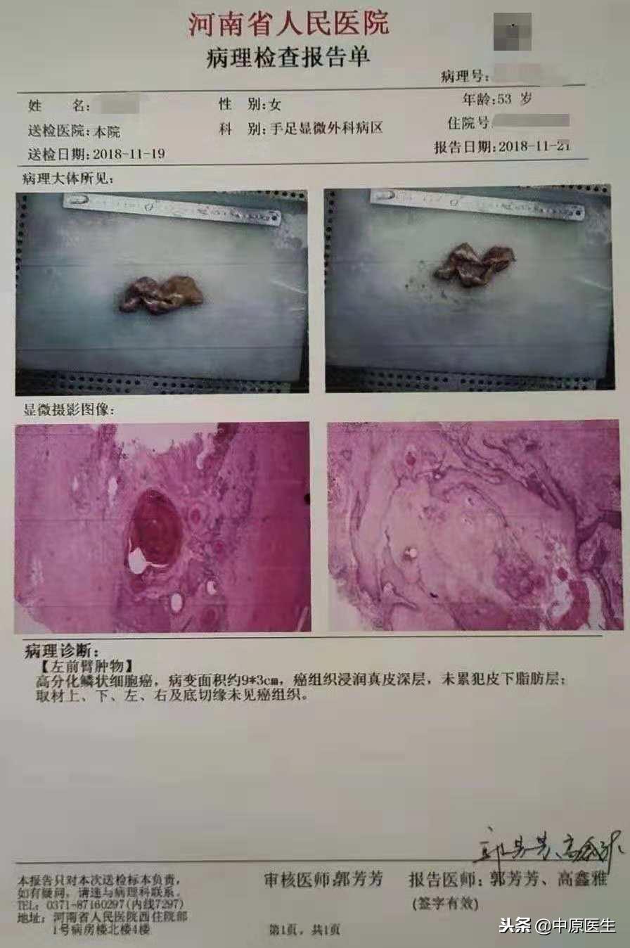 移花接木巧治癌症