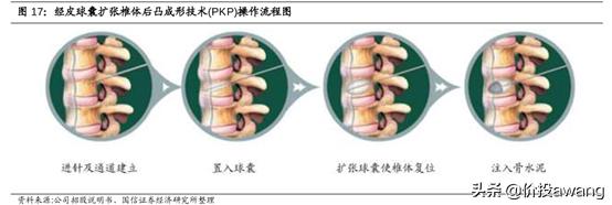 凯利泰为何被高瓴资本看中,淡马锡对凯利泰的评价