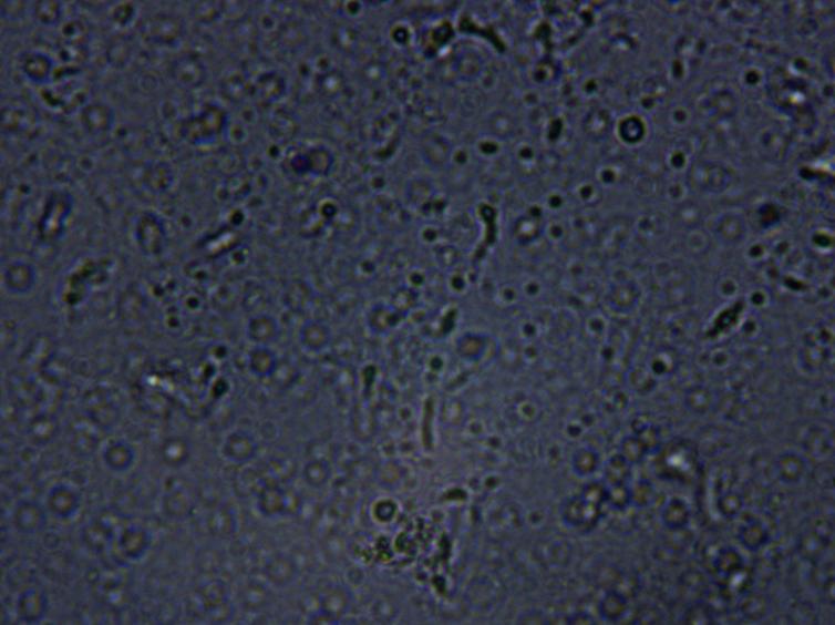 有苦难言的肛门问题，作为家长你了解吗