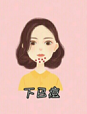 男生脸上各个部位长痘痘图解,脸上不同部位长痘痘的原因