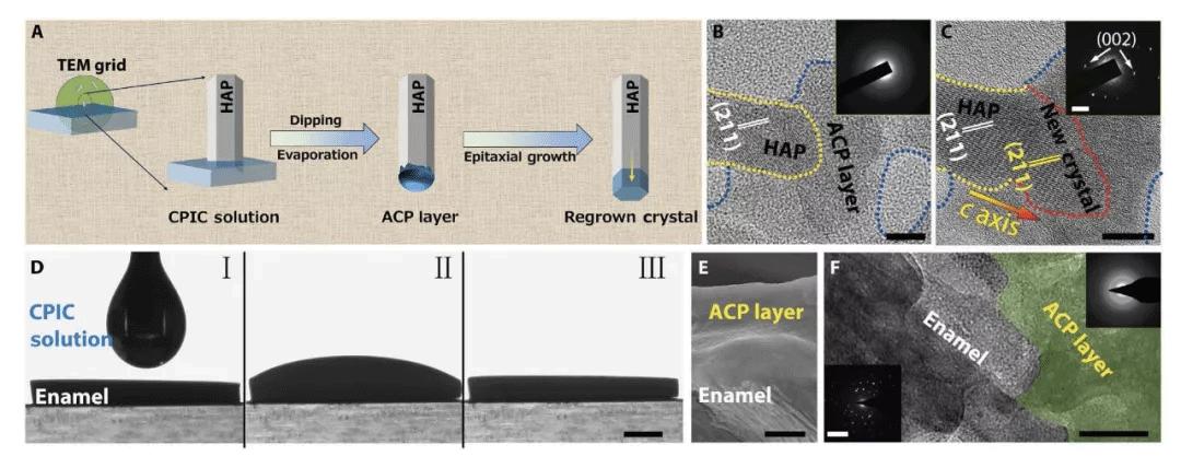 浙江大学牙釉质修复最新,浙江大学牙齿再生术