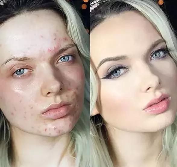 只有粉底液和遮瑕怎么化底妆,遮瑕粉底液和粉饼三个都要用吗