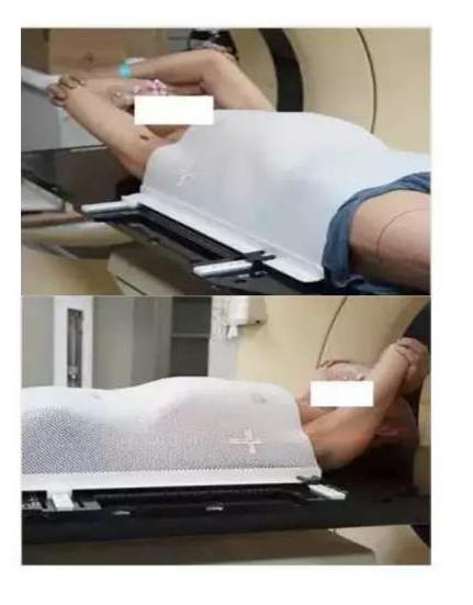 肿瘤患者化疗后体重增加了,肿瘤病人术后康复体重上升好吗