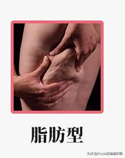 大腿粗怎么才能练壮,大腿粗怎么练腿变细