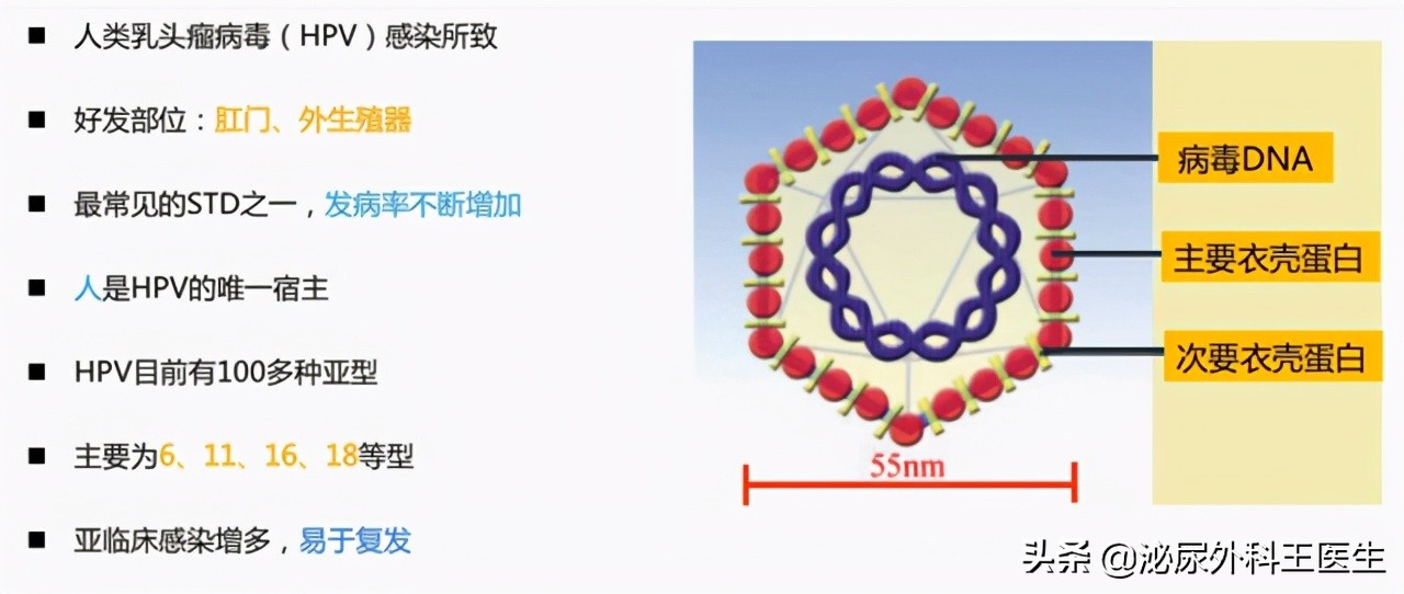 肛门摸到了小肉球，是痔疮还是尖锐湿疣？医生来教你区分