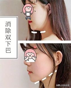 小红书用户分享的双眼皮、高鼻梁、小V脸、减肥方法，好评or差评