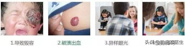 听说红胎记是福气的象征？你信不信