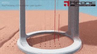 常见的5种激光美容手段，总有一款适合你