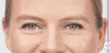 资生堂微针眼膜好不好用,日本资生堂小熨斗眼膜