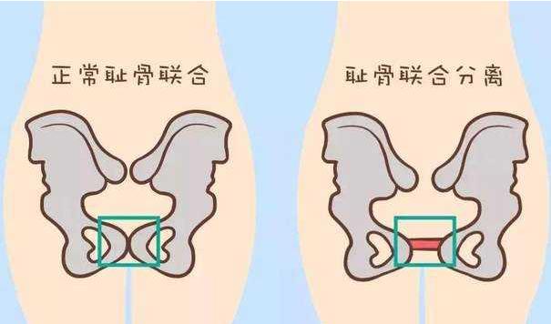 孕晚期各种难受难熬,孕晚期难熬各种不舒服