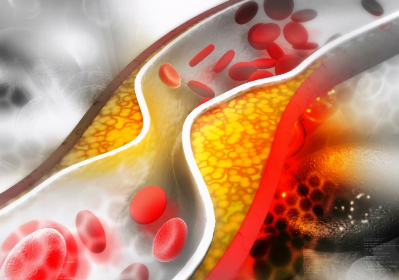 对血脂有影响的药物,对血脂高有好处的是什么维生素