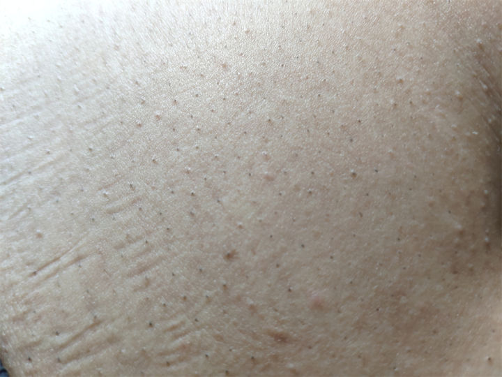 米家脱毛仪,米家脱毛仪测评