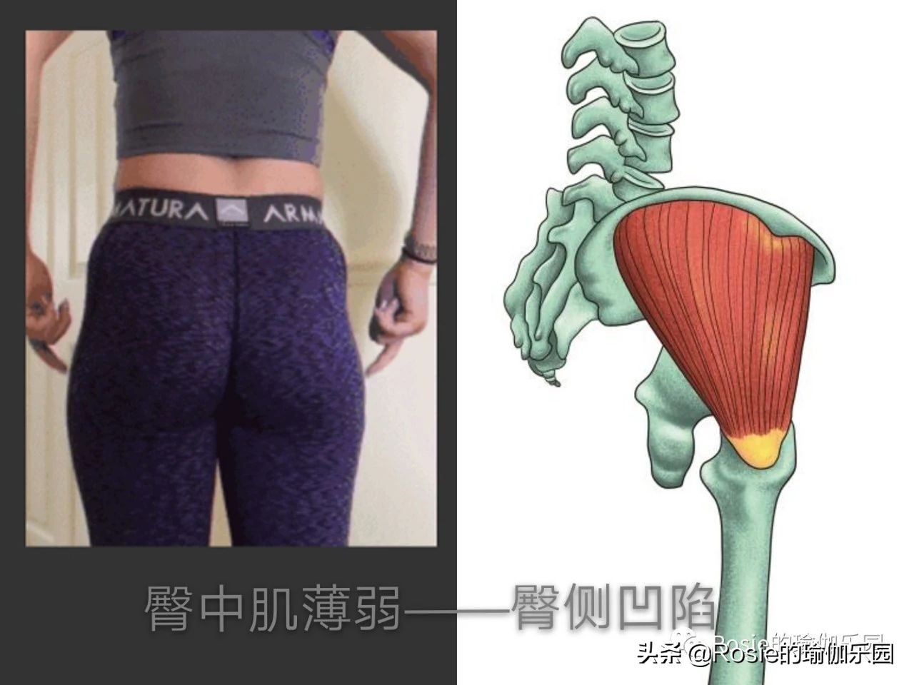 真翘臀和假翘臀怎么辨别,翘臀本来就有点骨盆前倾吗