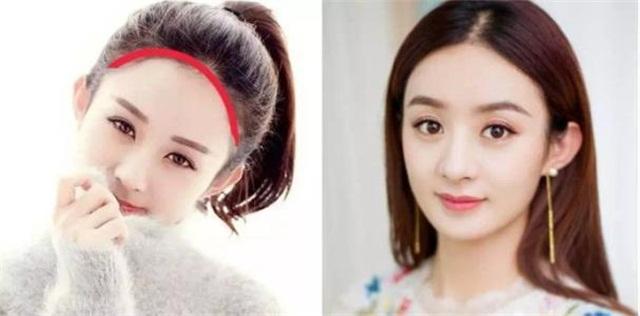 发际线补救视频,发际线后移的原因和补救方法