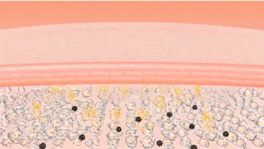 眼霜有必要用好一点的么,眼霜一般有没有用