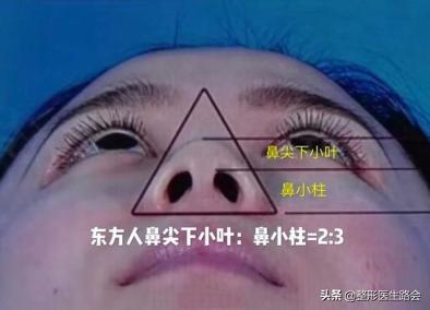 鼻翼缩小和鼻翼缩小之后的对比,超有效的缩小鼻翼的方法