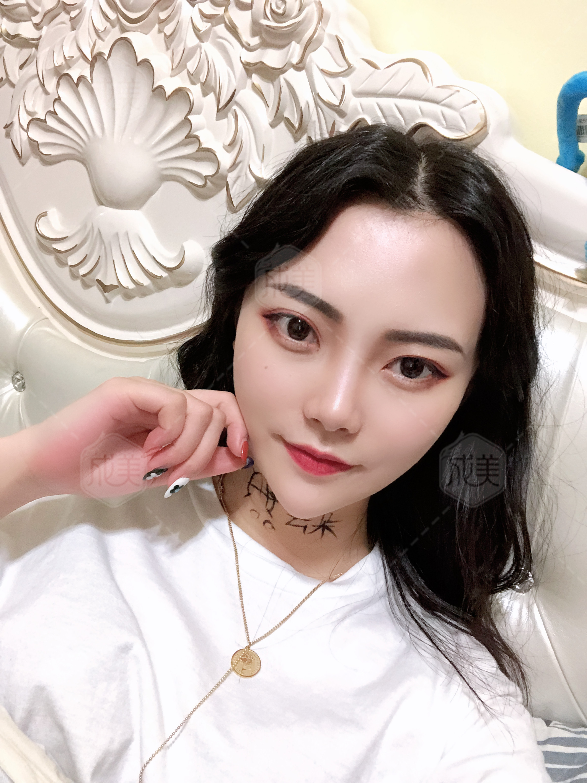 硅胶隆鼻没效果修复遭罪吗,硅胶假体隆鼻不满意最佳取出时间