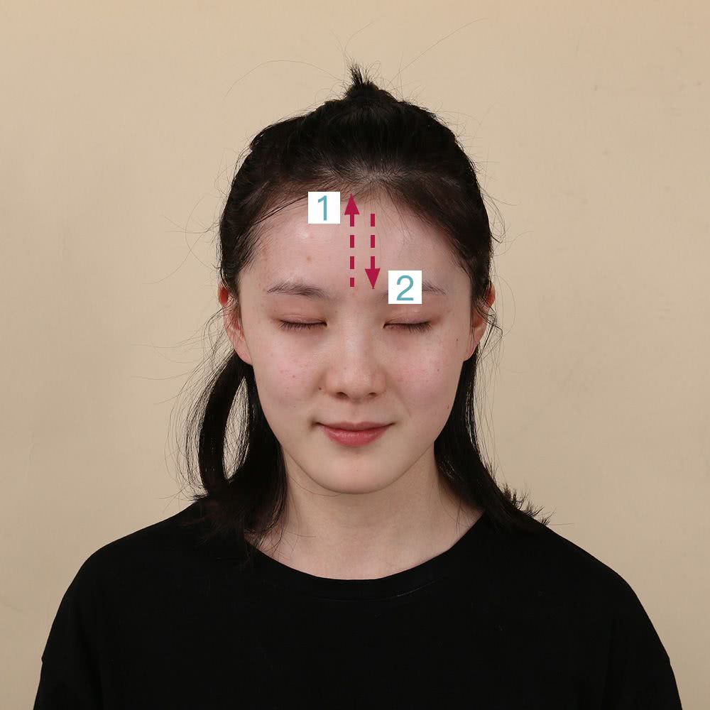 微整的真实效果,微整蜕变过程