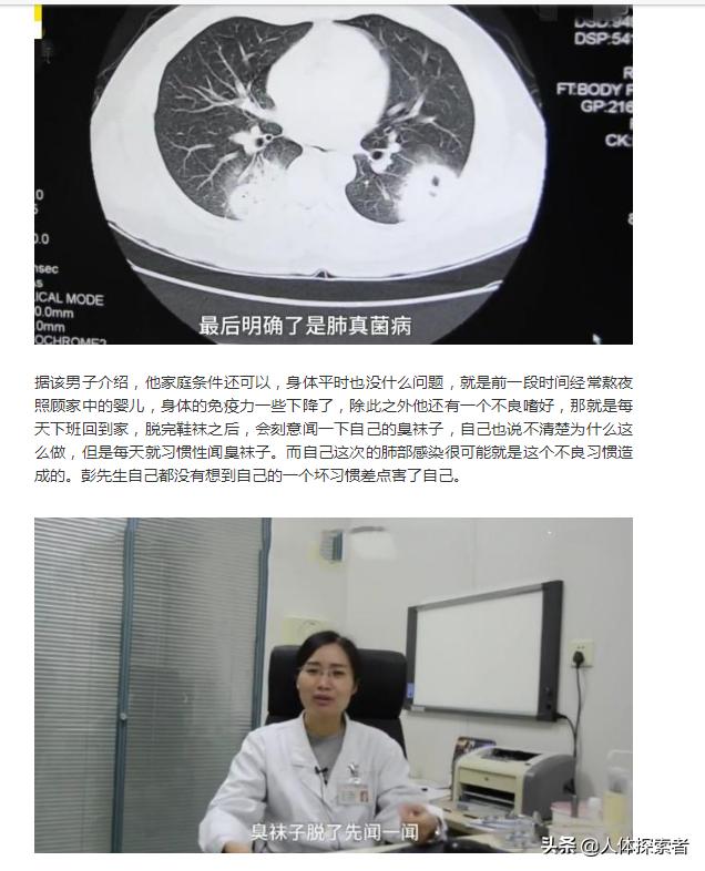 痰是什么病的症状,痰是由什么和什么组成的