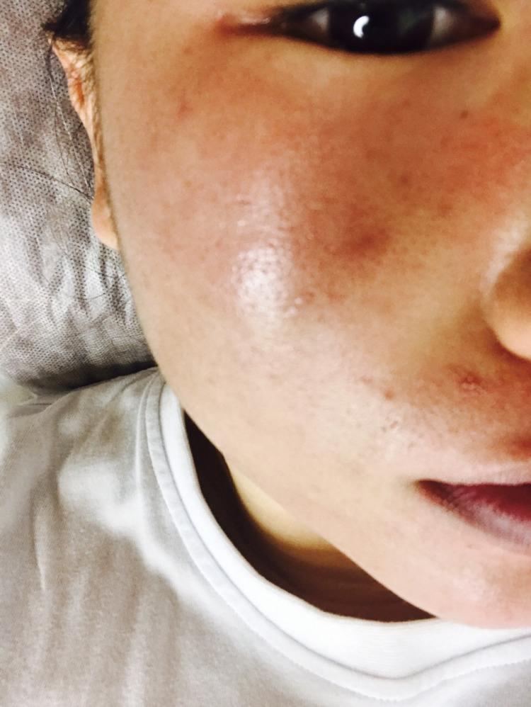 毛孔粗大肤质差如何去收缩毛孔,遮毛孔粗大收缩毛孔最有效的方法