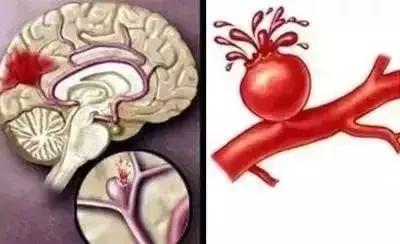 倒春寒的时候女性最怕什么,倒春寒身体冷