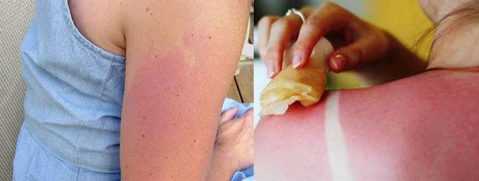 防晒衣超级宽松,韩国透气防晒衣