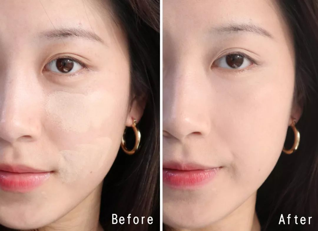 一张脸花了多少钱,一张脸总共需要多少钱