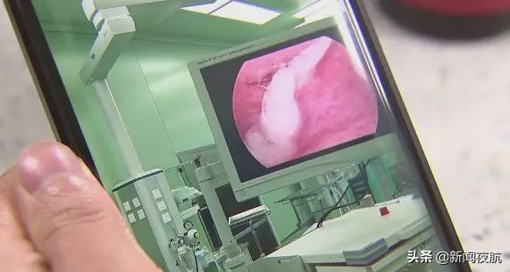 孩子鼻子塞进异物抠出来后流血,小孩被异物插进鼻子流血怎么办