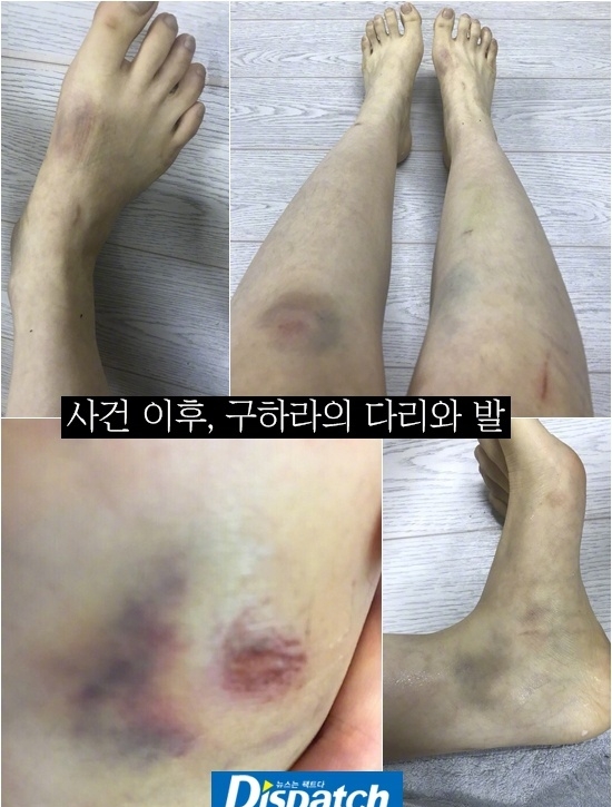 具荷拉自杀：人间不值得，你值得