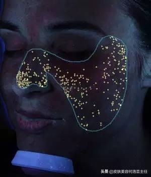 visia皮肤检测是什么原理,visia皮肤检测值多少是正常的