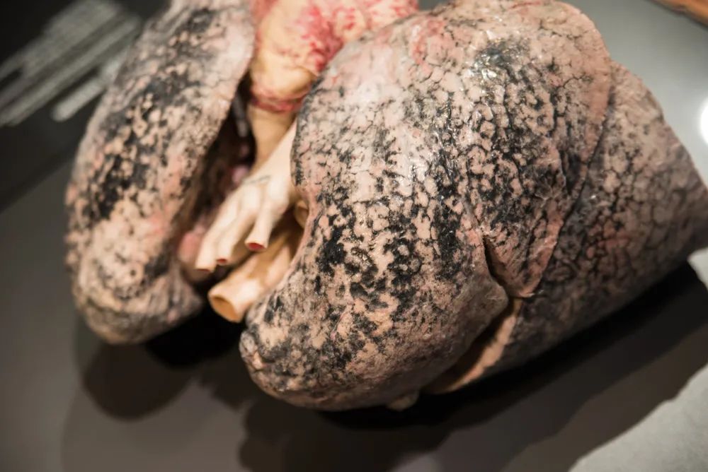 戒烟以后多久肺会恢复变白,吸烟的肺会自然好转吗