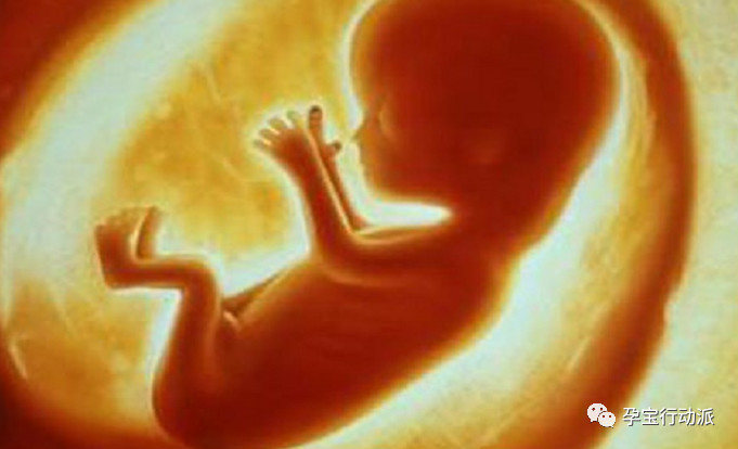 宫内胎儿发育迟缓怎么办,胎儿宫内发育迟缓该怎么办