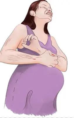 甘胆酸检查能查胆汁淤积吗,甘胆酸纳入肝功测试