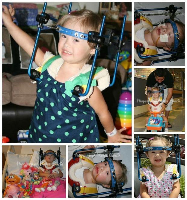 唐氏综合症少女模特,唐氏综合征女孩被美国收养