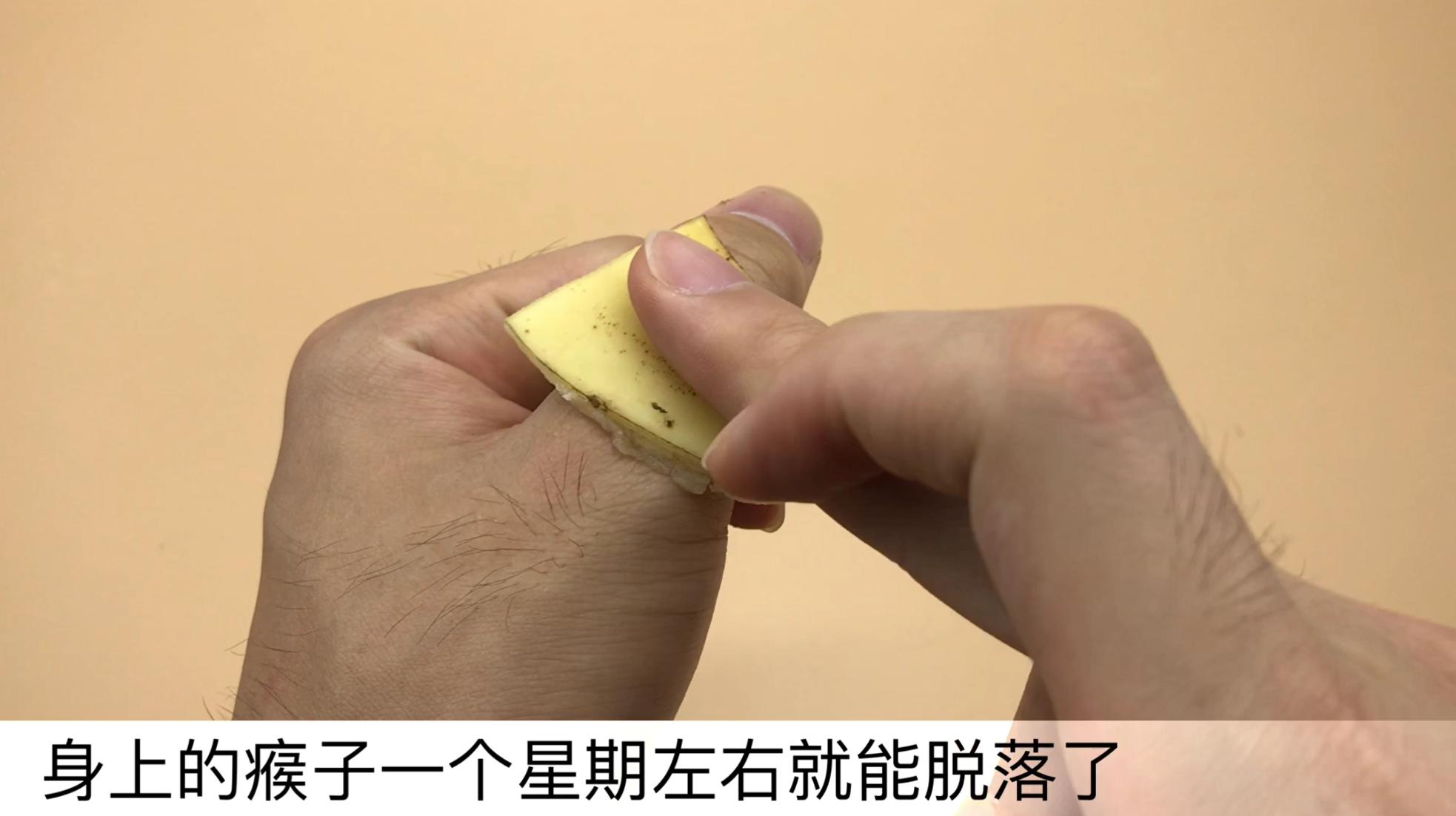 香蕉皮太厉害了，好多人的难题全都解决了，看完赶紧告诉家里人