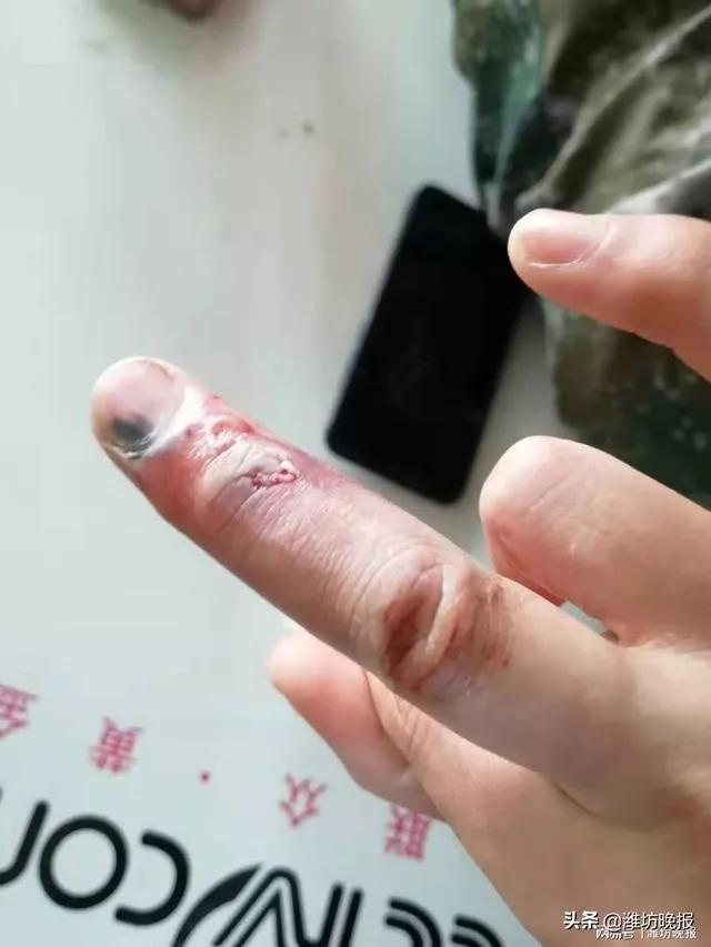 这场疫情给每个人什么启示呢 (这场疫情告诉大家的道理)