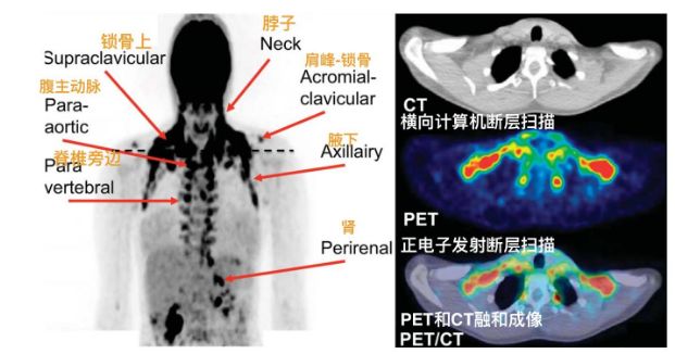 腿毛长不用穿秋裤,腿毛太长冬天穿秋裤简直就是噩梦
