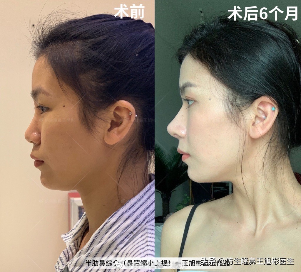 被鼻子封印的颜值,那些被鼻子封印的颜值