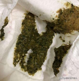 宝宝拉绿便不怎么长肉喝什么奶粉,宝宝拉绿色便便是妈妈吃凉的了吗