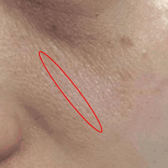 25岁毛孔粗大用什么补水,25岁毛孔粗大暗沉用的精华