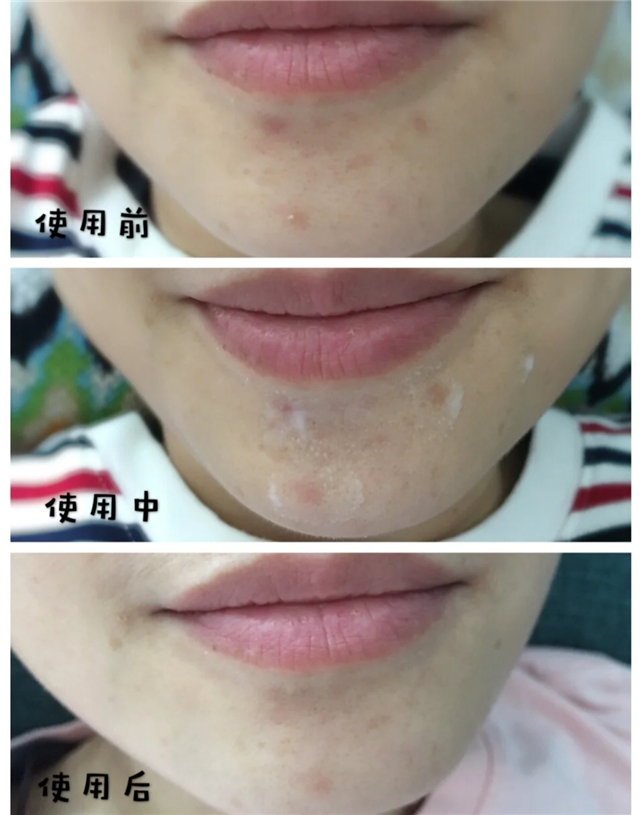 一见到女生就会脸红怎么回事,一出门脸就泛红怎么回事