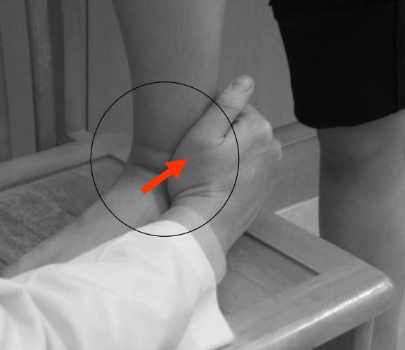 踝关节扭伤两个多月走路还跛脚,踝关节扭伤五个月了走路很痛还肿