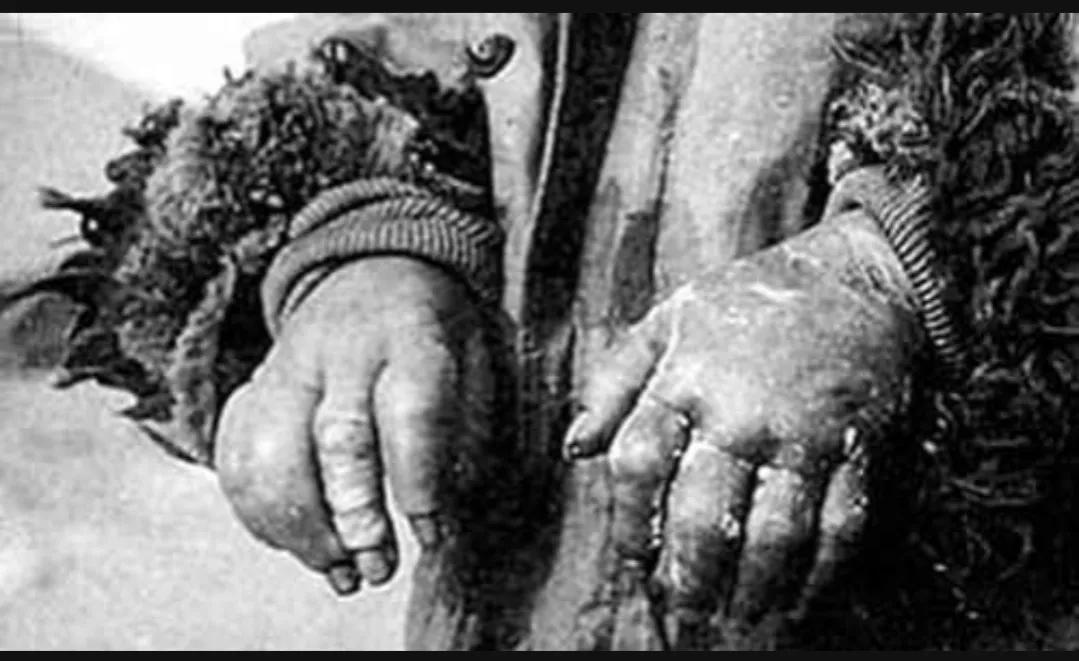 日军731部队冻伤实验是为了什么,日军731实验照片