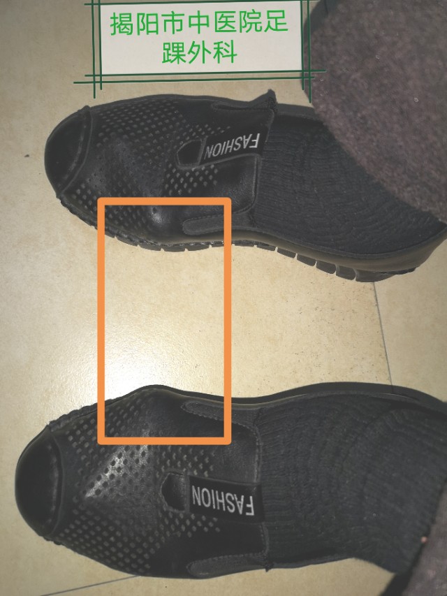 关注足部的健康,关注足部健康