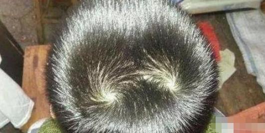 孩子头顶有两个旋性格,男孩头顶两个旋迷信说法