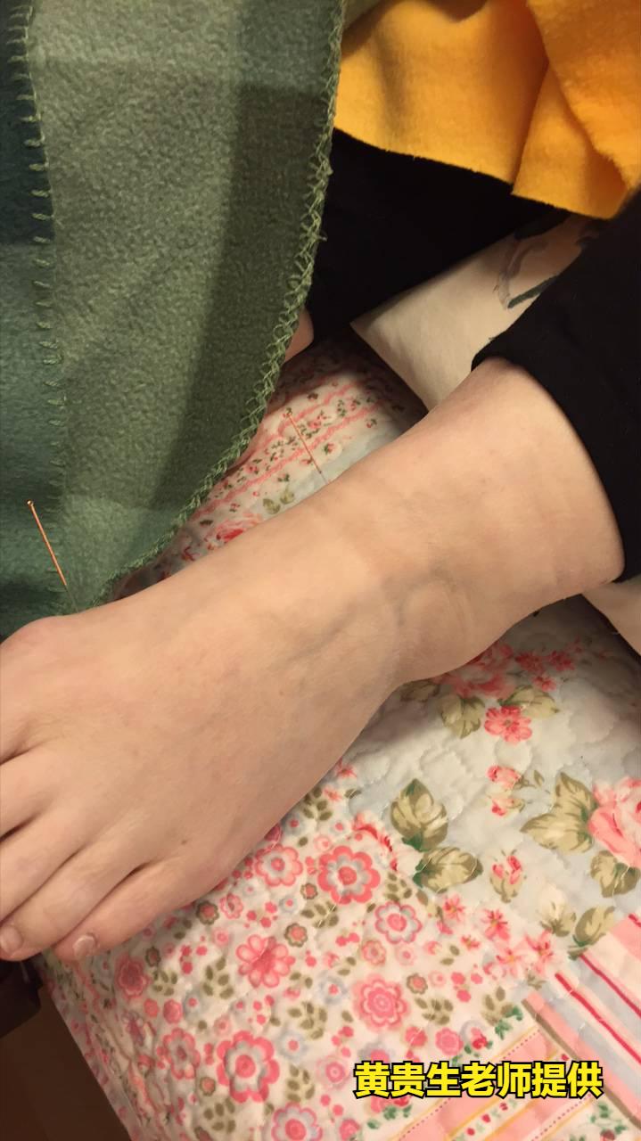 和癌症一起做斗争,癌症防治大赛