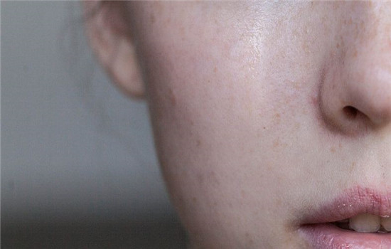 敏感肌红血丝该怎么修复,敏感肌红血丝怎么修复