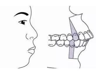 很多人都有的牙齿深覆合，看完后，你会得到重视...