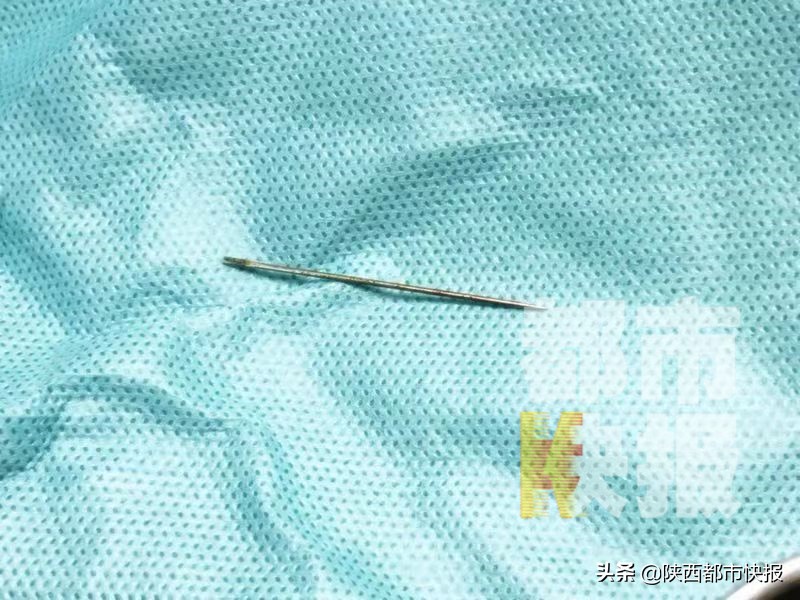 缝衣针扎到手要打破伤风吗,缝衣针戳到手肿了