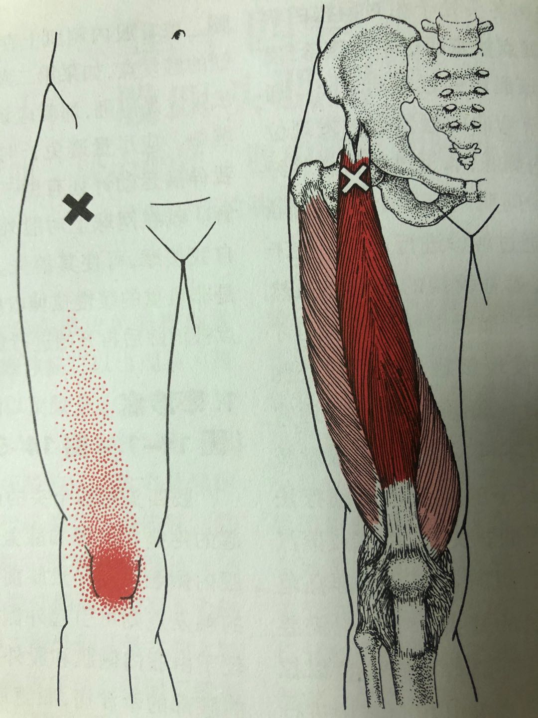 膝关节疼痛要做的体格检查,膝关节痛要拍什么可以确诊